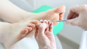 how to cut toenails to prevent ingrown